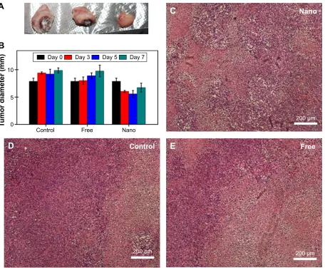 Figure 5 Changes after treatment with drugs in size and histochemistry.Notes: (A) Optical image that shows the tumor reduction in mice injected with nanoparticle-loaded drugs