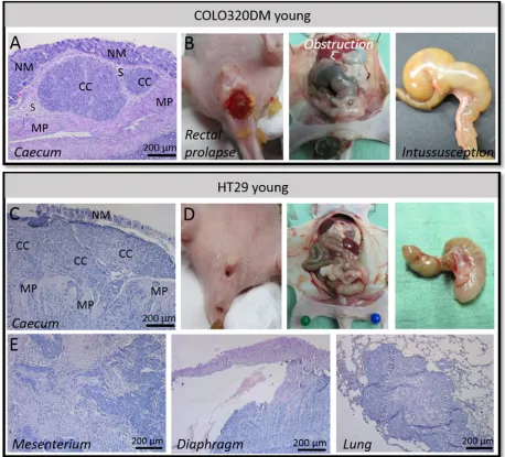 Table 1: Local tumor growth and appearance of rectal prolapse in young or adult mice SC or orthotopically injected with human CRC cell lines