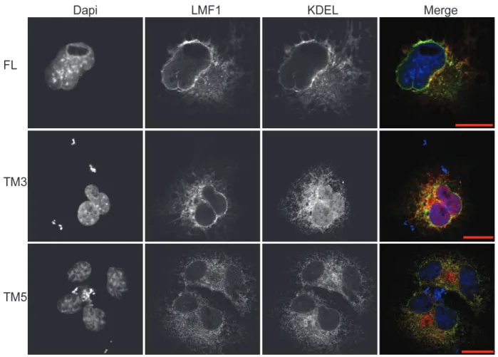 Figure 2.2 LMF1 truncation variants localize to the ER. 