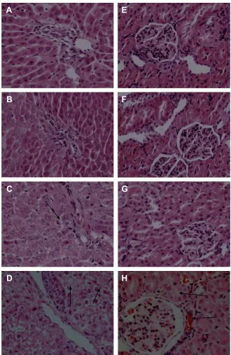 Figure 7 effects of ZnO nanoparticles on the histopathologic appearance of liver and kidney tissues (he ×400).Notes: liver: control group (A), 100 mg/kg (B), 300 mg/kg (C), and 600 mg/kg (D)