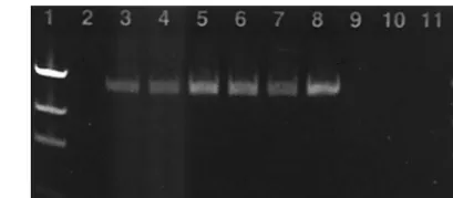 FIG. 3. Electrophoretic gel proﬁle of RT-PCR products generatedusing the Applied Biosystems ViroSeq HIV-1 genotyping system