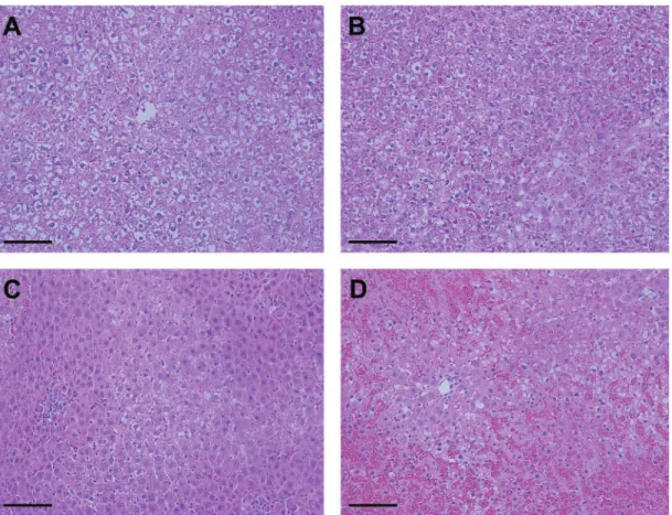FIG. 1. Histopathology of rat liver sections 24 h after APAP treatment. Representative photomicrographs of H&amp;E stained liver sections from rats 24 h after administra- administra-tion of (A) 0.5% methylcellulose vehicle, (B) 500 mg/kg APAP, or 1400 mg/k