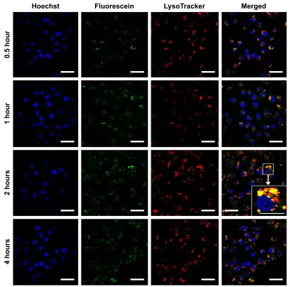 Figure 8 Intracellular trafficking of FL-PTX-CH Emul in MDA-MB-231 cells at different time intervals (0.5, 1, 2, and 4 hours)