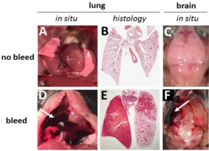Figure 2. Lung and brain bleeds in Low-TF mice lacking PAR-4