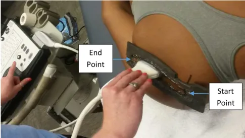 Figure 3. US probe placement End Point 