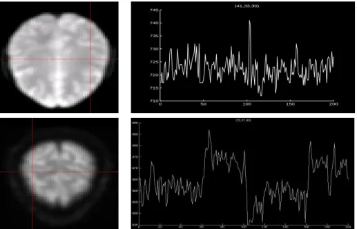 Figure 2.3: Examples of two time series corresponding to two different voxels recorded in an fMRI experiment