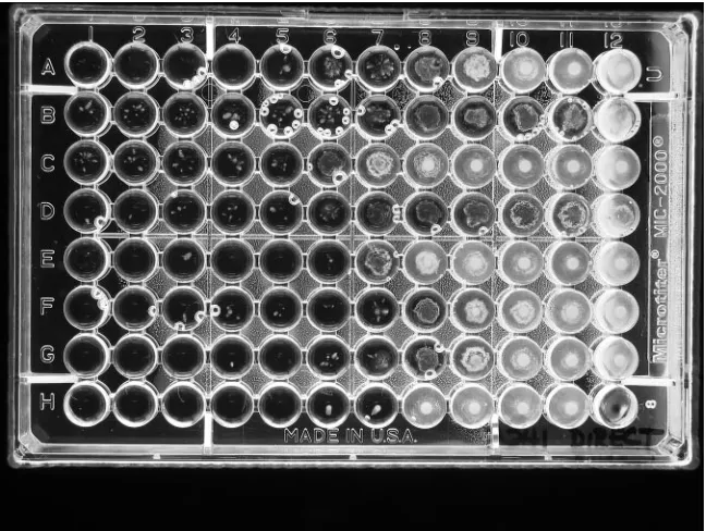 TABLE 1. Species identiﬁcation of 196 Acinetobacter sp. isolatesand frequency of isolates that express very majorerrors by disk diffusion