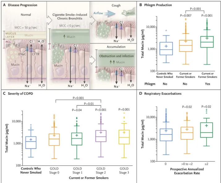 Figure 1. Associations between Total Mucin Concentrations and Phlegm Production and Disease  Severity in Chronic Obstructive Pulmonary Disease (COPD)