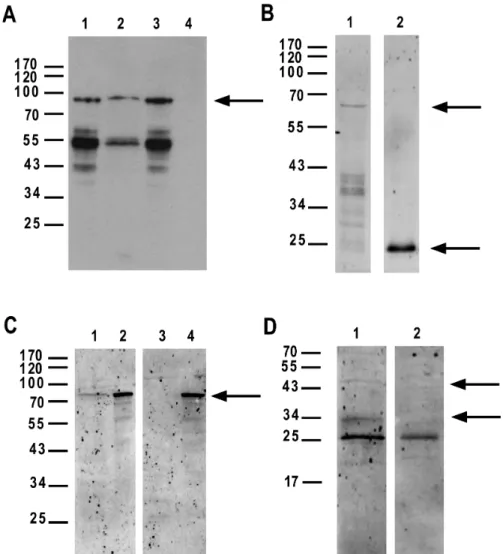 Figure  2. CAPN3 and PARVB can directly interact. A: Immobilized GST-fused PARVB can  pull down recombinant CAPN3 from a bacterial T7-tagged CAPN3 lysate (Lane 2 vs 1), where  unfused GST cannot (Lane 4 vs 3)