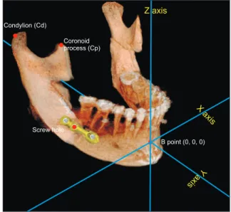Figure 2. The X, Y, and Z coordinates and landmarks on a  cone-beam computed tomography image.
