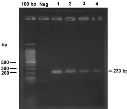 FIG. 5. Immunoblot of Pwith serum from a pythiosis patient. Lanes 2 to 4 and lane N, reactionswith serum from a penicilliosis patient, preimmunized rabbit anti-serum, immunized rabbit antiserum, and pooled human sera (fromhealthy persons), respectively