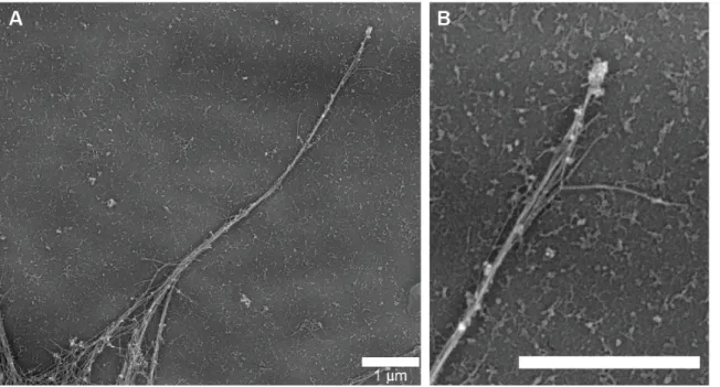 Figure 3.1.  Platinum replica electron micrograph of an individual filopodium 
