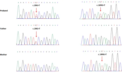 Figure 4: Partial DNA sequences in the WDR62 by Sanger sequencing of the family. Upper line: the proband, middle line: the father, bottom line: the mother