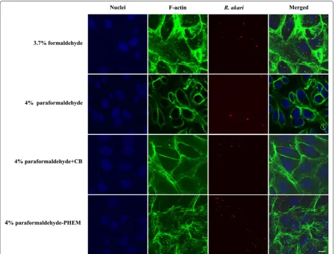 Fig. 1 Indirect immunofluorescent staining of Vero cells infected with R. akari and comparison of four fixative solutions