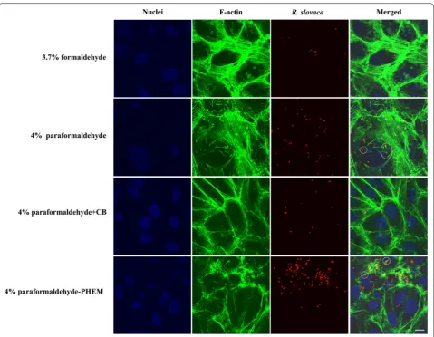 Fig. 2 Indirect immunofluorescent staining of Vero cells infected with R. slovaca and comparison of four fixative solutions