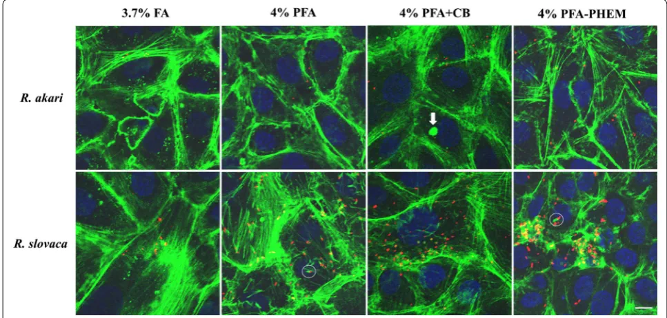Fig. 3 Merged images of infected Vero cells with rickettsiae and comparison of four fixative, summary of results