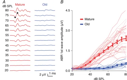 Figure 1. CBA/CaJ mice show ARHL A, example ABR waveforms recorded from mature and old mice in response to clicks.
