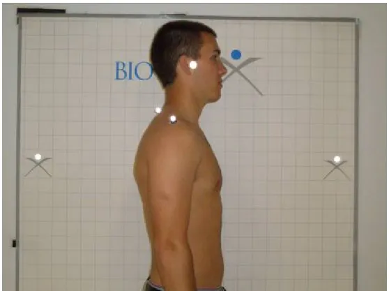Figure 2: Postural Screening  No Brace 