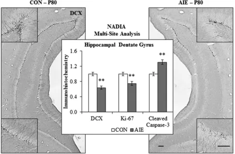 Fig. 4. Alcohol disrupts the basal forebrain cholinergic system in rats and humans. Top: Simplified schematic of the cholinergic system of the brain.