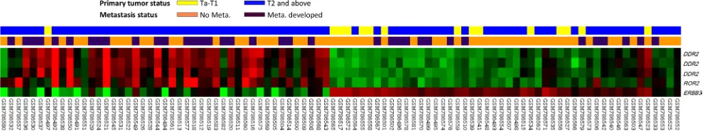 Figure 1: Gene expression profile analysis in urinary bladder urothelial carcinoma from a published transcriptomic dataset (GSE31684)