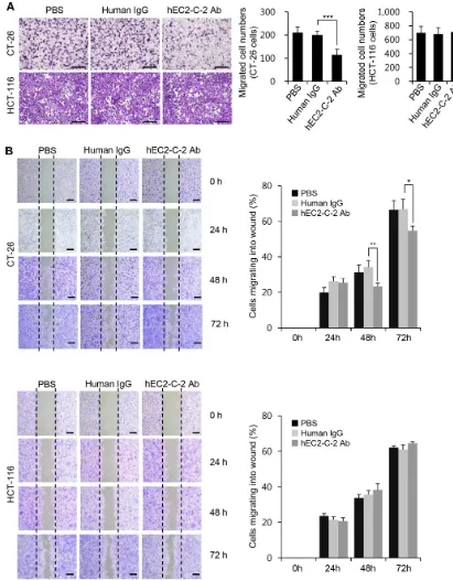 Figure 7: Effects of the humanized anti-TM4SF5 monoclonal antibody on the migration of colon cancer cells