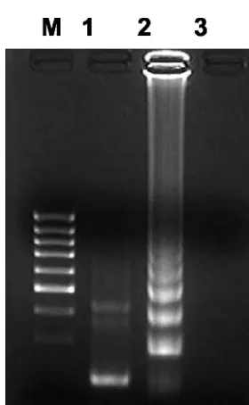 FIG. 1. Oligonucleotide primers used for RT-LAMP ampliﬁcation of SARS-CoV (GenBank accession number NC-004718)