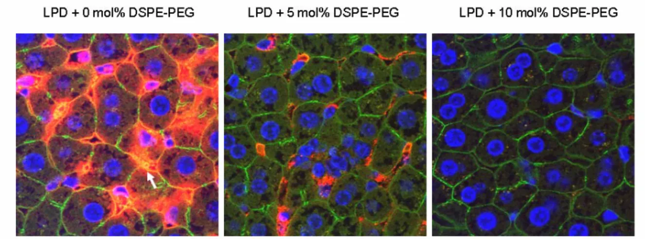 Figure 2.8 Liver sinusoidal uptake of cy3-siRNA (red) in different LPD formulations. 