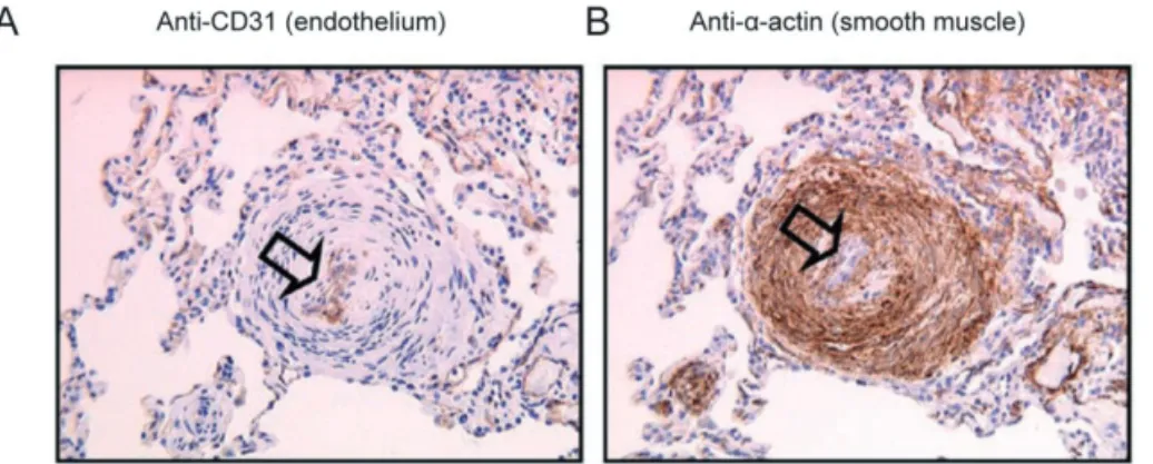 Figure was repro- duced from [97], with permission from Dr N Morrell and Lippincott, Williams and Wilkins.