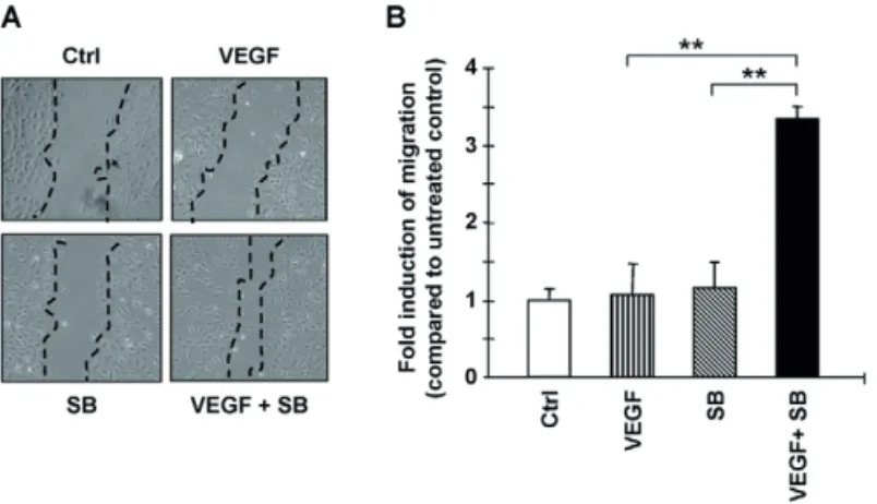 Fig. 5. Effects of SB-431542 and VEGF on EC migration. VEGF and SB- 431542 (SB) synergistically stimulate HUVEC  migration