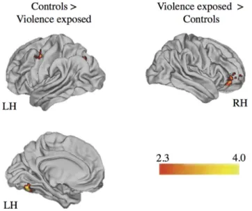Figure 10. Functional connectivity between the right posterior hippocampus and right vlPFC during context encoding (angry facial cue ⬎ ITI) and context memory accuracy on trials involving angry facial targets.