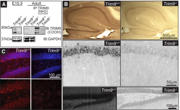 Fig. 3A). We compared the length and branching of axons and dendrites at 3 and 5 DIV (Fig