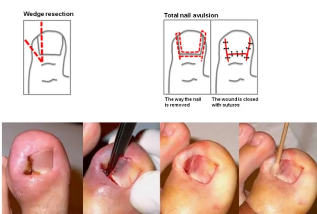 Figure 4. Surgical Interventions