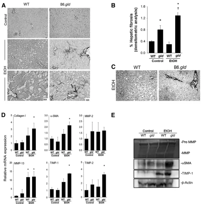Figure 3 Histologic analysis of ﬁbrosis and expression of a-SMA, collagen, and collagen-related genes