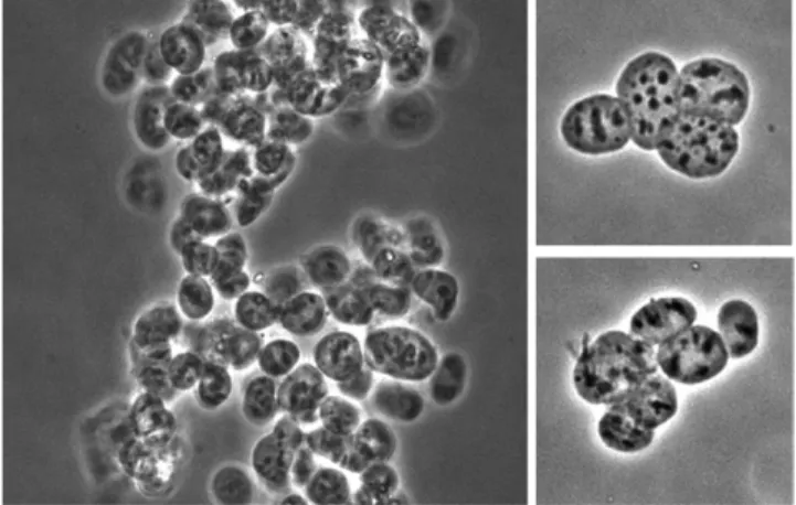 Fig. 5.  Electron microscopic analysis of envelope-free nuclear  preparations. A: Whole iMEF cell
