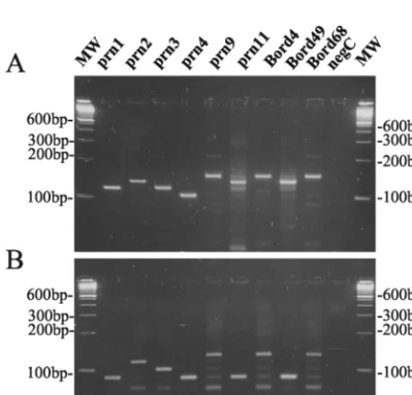TABLE 2. Ct values for representative prn strains and clinicalisolates with rare prn types for the QJF3-QJR1 andQJF4-QJR1 ampliﬁcations