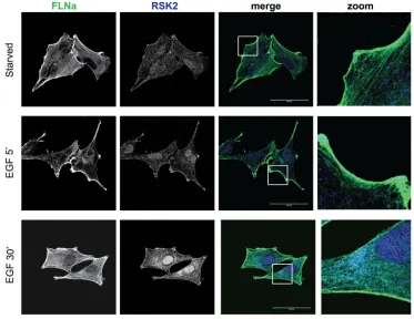 Figure 2: Individual RSK isoforms regulate GBM cell invasion in 3D. A. Stable U-373 MG cell lines with knocked down RSK1, -2, -3, or -4 isoform expression (shRSK1-4) or cells carrying a scrambled control vector (scr) were generated using two independent sh