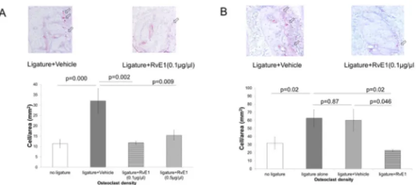 Figure 2. RvE1 treatment controls osteoclast activity