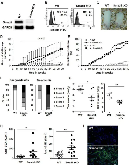 Figure 1: T cell-specific Smad4 deficiency increases the incidence of SS and accelerates disease onset in NOD mice