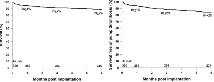 Figure 2 (A) Example of a con ﬁrmed PT event. (B) Example of a suspected but not conﬁrmed PT event.