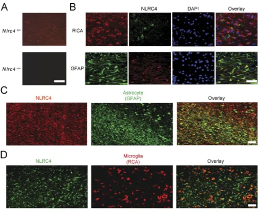 Figure 3.  nLrc4 is expressed in mouse  cnS during neuroinflammation and in  human brain tissue from MS patients