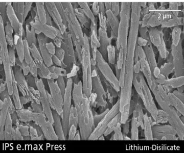 Figure 1: Lithium disilicate crystals in IPS e.max 