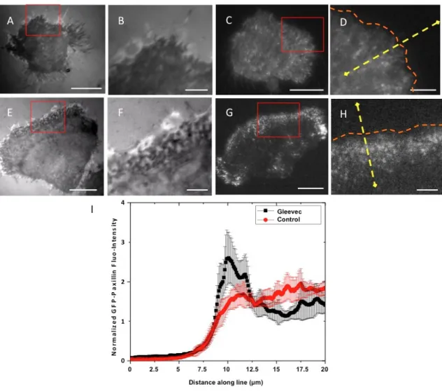 Figure 3.5. Punctuate adhesions are present at the leading edge of Gleevec treated NBT-II  cells