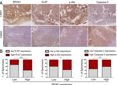 Figure 6: High SPHK1 expression was associated with increased Ki-67 and p-Akt and decreased caspase-3 expression in human NPC specimens