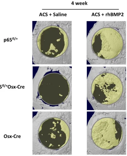 Figure 2.3 Micro-CT analysis of new bone formation in p65 fl/+ Osx-Cre, p65 fl/+  and Osx-Cre  mice at 4 weeks following surgery