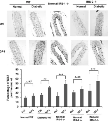 FIGURE 2. Smooth muscle-specific knockout of IRS-1 but not IRS-2 enhances IGF-I signaling in aortae from normal mice
