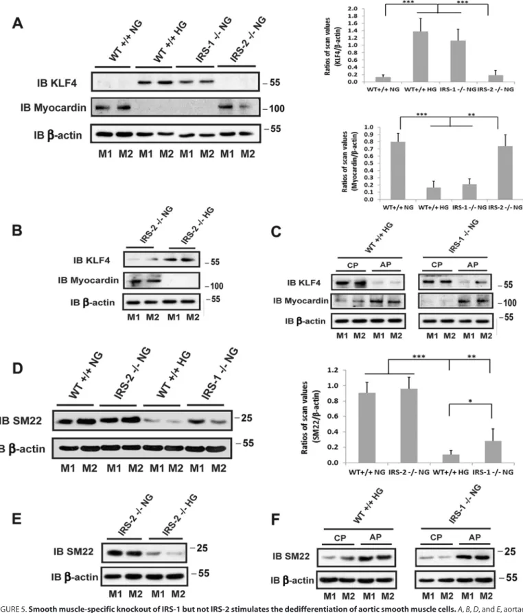 FIGURE 5. Smooth muscle-specific knockout of IRS-1 but not IRS-2 stimulates the dedifferentiation of aortic smooth muscle cells