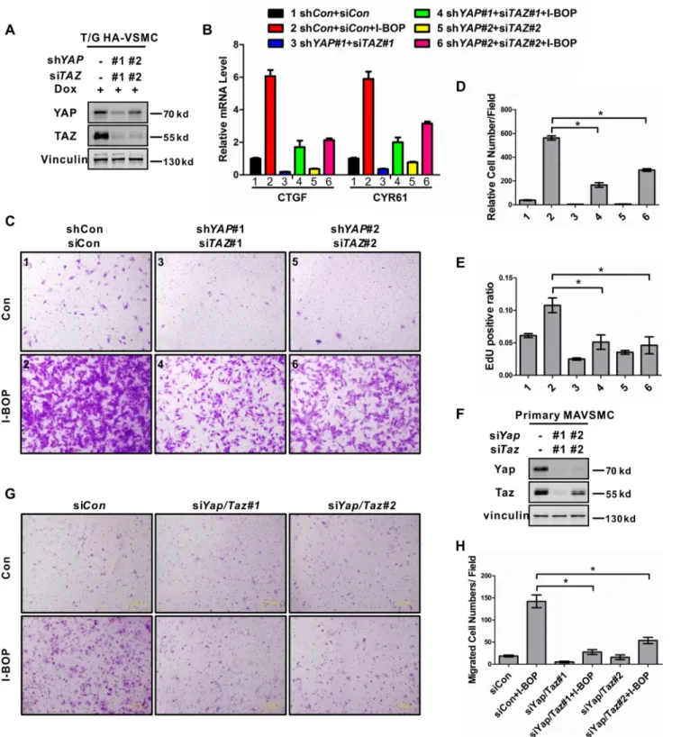 FIGURE 5. YAP/TAZ mediate the effect of TP in gene induction, DNA synthesis, and cell migration in VSMCs