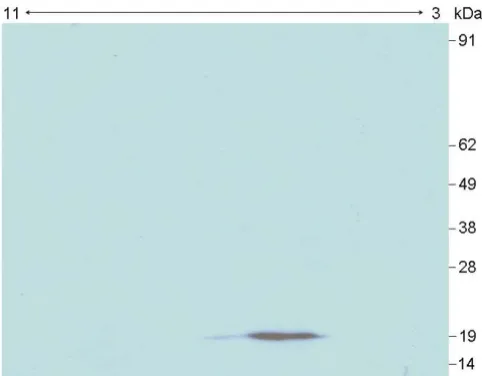 Figure 3Example of 2D ALBI assaytype 4 (strain PBi) against human serum, showing a reactive Example of 2D ALBI assay