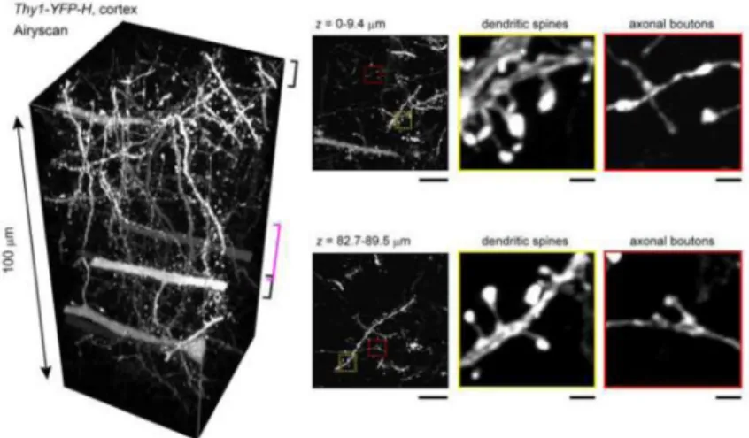 Figure 2. 100 μm slice of mouse brain - See DB2 technique
