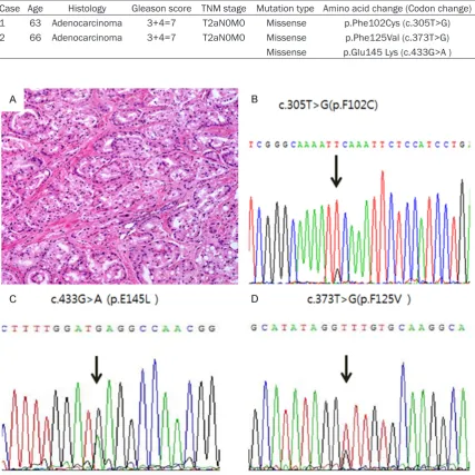 Table 3. Features of cases with SPOP missense mutation